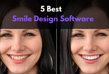 Best Smile Design Software